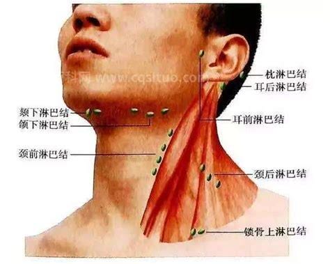 下颌淋巴肿大的症状和治疗