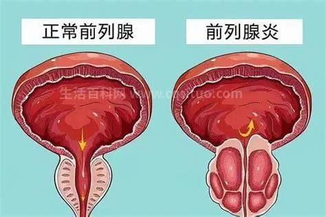 常见泌尿系统疾病有哪些