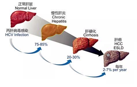 肝病有哪些