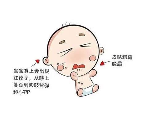 新生儿热疹怎么消下去