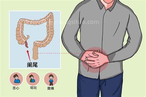 阑尾炎痛怎么止痛方法