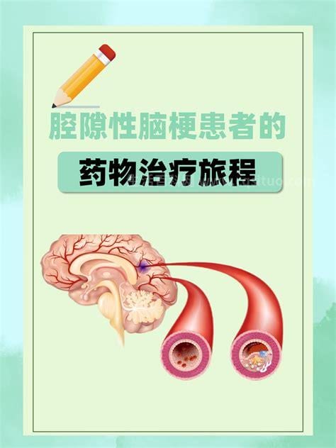 脑腔梗最佳治疗方法是什么