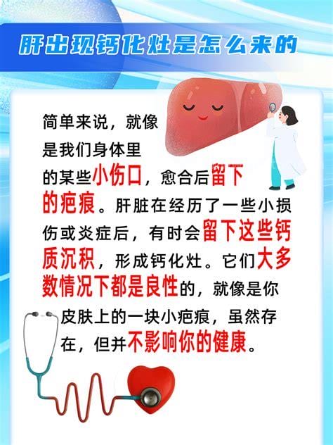 钙化灶是什么意思