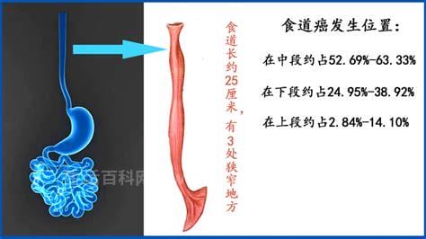 食道癌是怎么引起的