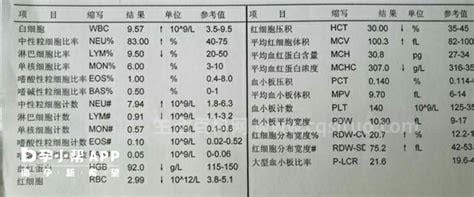 地中海贫血血常规哪些指标不正常