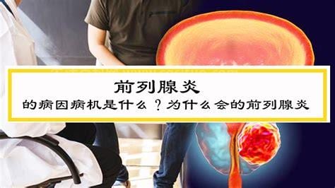 前列腺炎的病因是什么