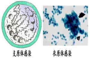 支原体衣原体能自愈吗