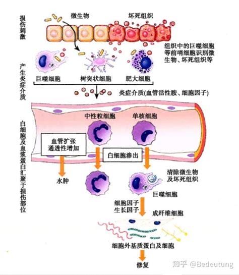 炎症是怎么导致的